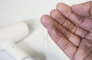 西宮北口で抜け毛予防や抜け毛対策について、知りたい改善したい方は必見です。