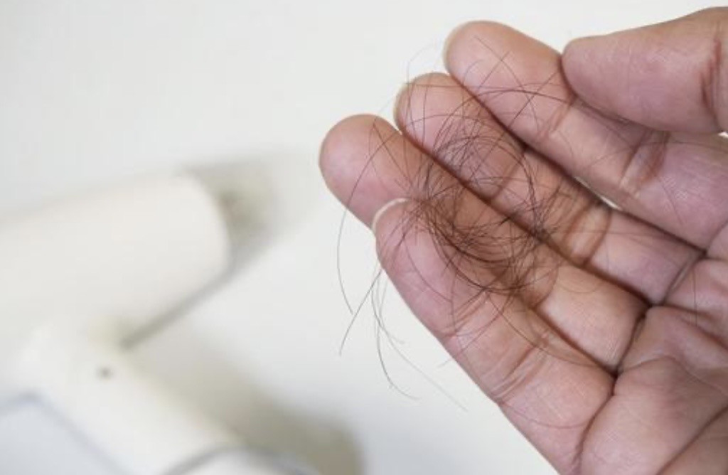 西宮北口で抜け毛予防や抜け毛対策について、知りたい改善したい方は必見です。