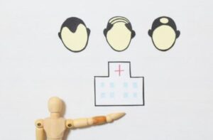 AGAを服用するかしないか?考えてみる。